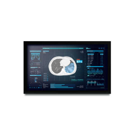 Medical Displays
